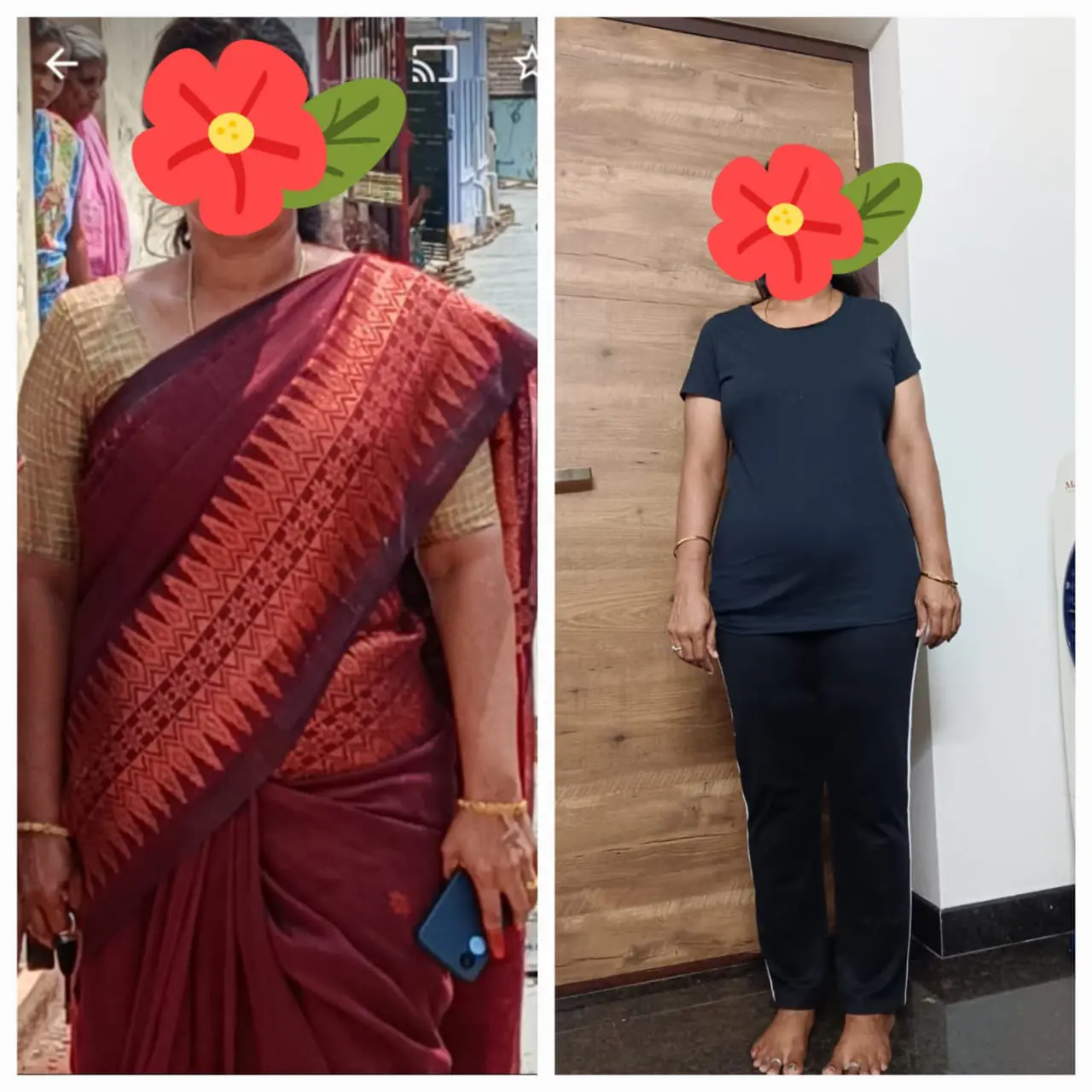 Sona before and after transformation